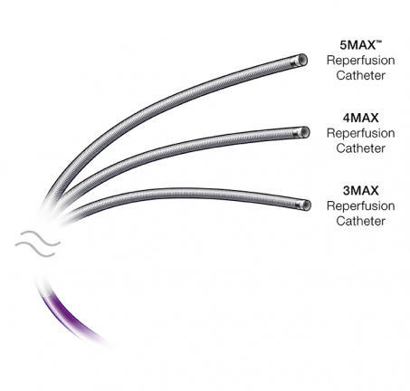 MAX<sup>™</sup> Reperfusion Catheters