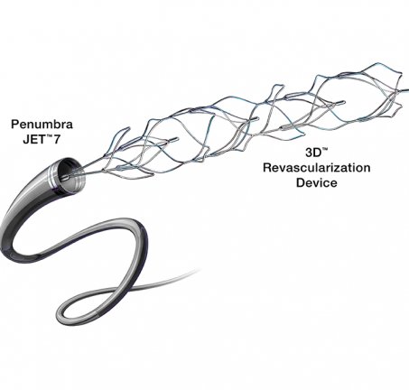 3D Revascularization Device<sup>™</sup>