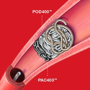 Blog Image of Illustration of POD 400 & PAC 400 in a vessel with text reading "POD 400™. PAC 400™"