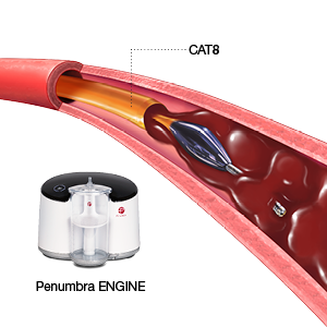 Meetings & Events: Penumbra Announces Key Events at VIVA 2019