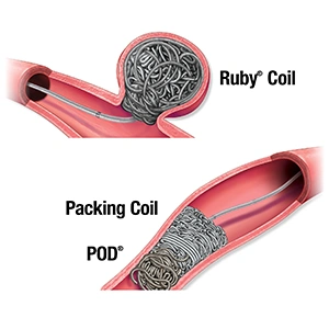 Blog Illustration of Ruby Coil, Packing Coil, and Pod in vessels with text reading "Ruby® Coil. Packing Coil. Pod®"