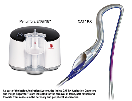 Indigo<sup>®</sup> System CAT RX