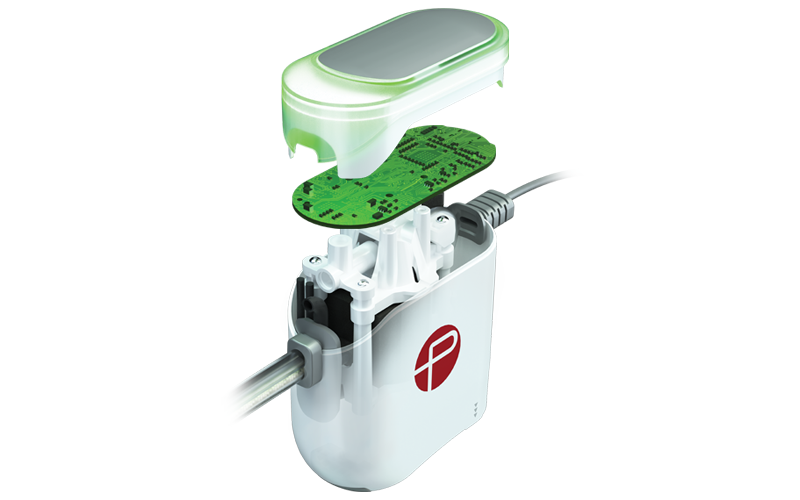 The Next Generation of Thrombus Removal