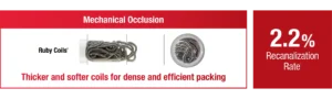 Mechanical Occlusion showcasing recanalisation rate (details below) with text "Thicker and softer coils for dense and efficient packing"