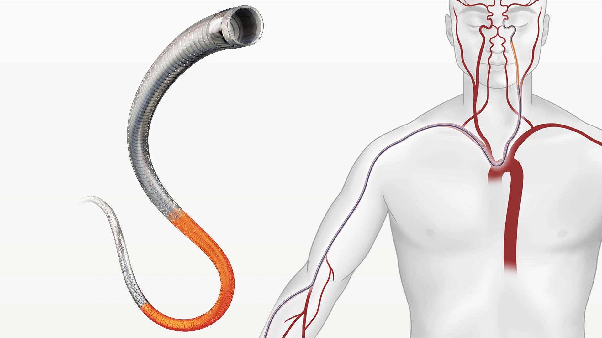 Illustration of the Tip of the BENCHMARK 071 Access Catheter for use in neurovascular access and an illustration of the map of arteries and veins it can access on a human