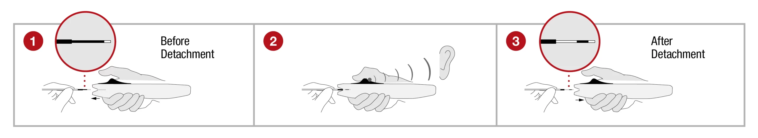 Diagram illustrating instructions on how to use detachment handle