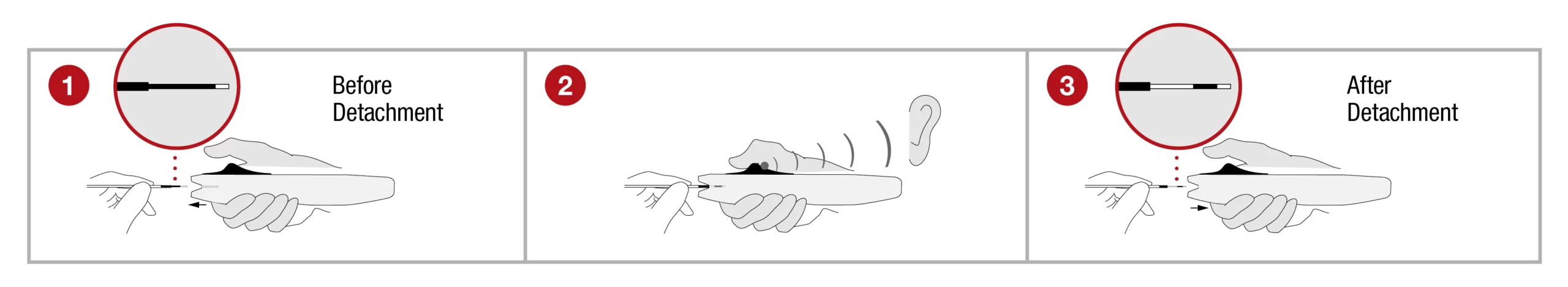 Diagram illustrating instructions on how to use detachment handle with 3 individual steps contained in boxes and text "before detachment" in box 1, and text "after detachment" in box 3. Box 2 suggests a clicking an audible clicking sound will be made when detached. 