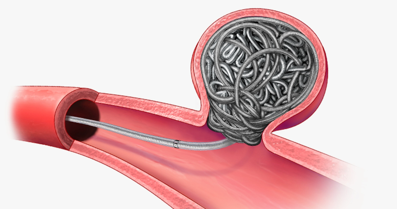 rendering of Ruby Coil XL Deployment vessel