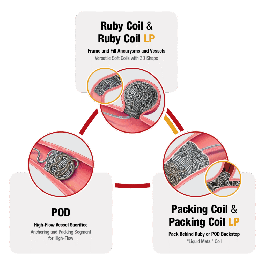 Graphic displaying Embolisation system products, uses, and sizes (dimensions below) in a triangle formation with text "Ruby Coil - Frame and Fill Aneurysms and Vessels - Versatile Soft Coils with 3D Shapes" , "POD - High-flow vessel sacrifice - Anchoring and Packing Segment for High-Flow" "Packing Coil - Pack Behind Ruby or POD Backstop - Liquid Metal Coil"