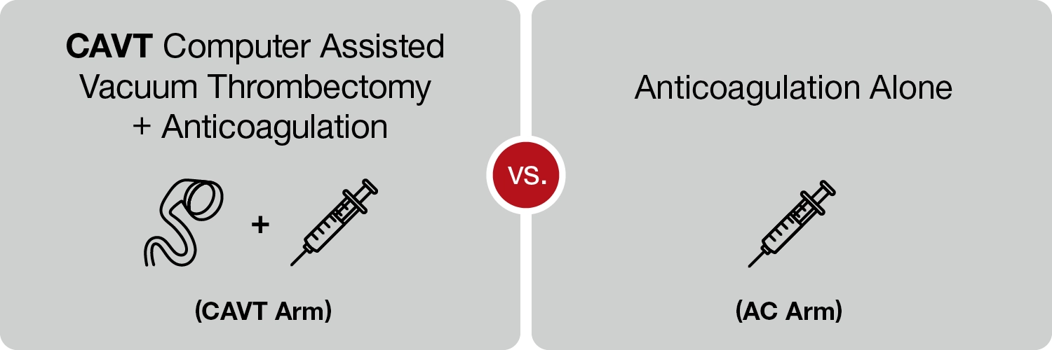 Diagram comparing treatment arms: CAVT, defined as computer‑assisted vacuum thrombectomy plus antico…