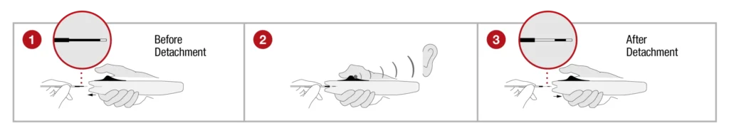 Diagram illustrating instructions on how to use detachment handle with 3 individual steps contained in boxes and text "before detachment" in box 1, and text "after detachment" in box 3. Box 2 suggests a clicking an audible clicking sound will be made when detached.