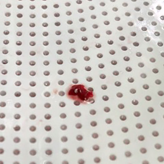 Angiogram of blood clot on perforated white surface