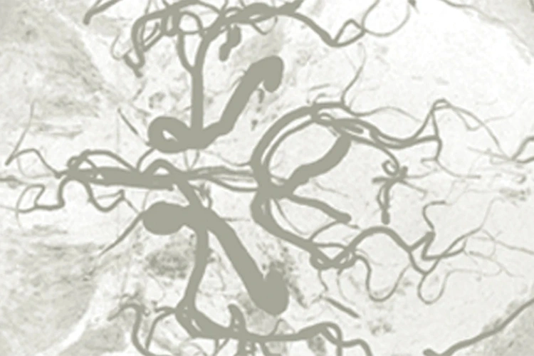 Stock photo of neurovasculature