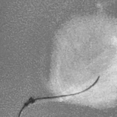 animation of ACCESS25 Delivery Microcatheter tracking