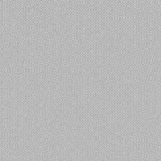 angiogram of an embolization coil deployed in the body