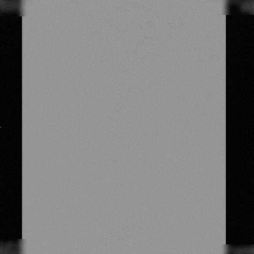 angiogram of embolization coils deployed in a body