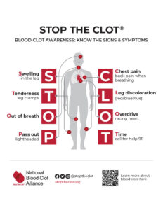 A a graphic acronym providing blood clot signs and symptoms. 