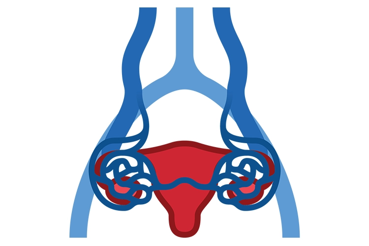 Illustration of pelvic venous anatomy