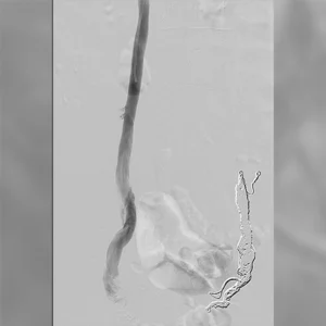 Medical imaging of vascular structure