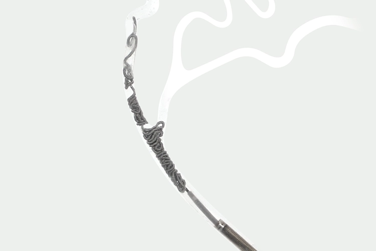 Embolization coils deployed in a model of the MMA.